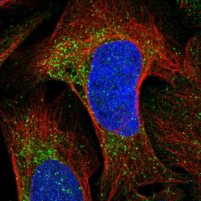 Atlas Antibodies Anti-CKLF Antibody