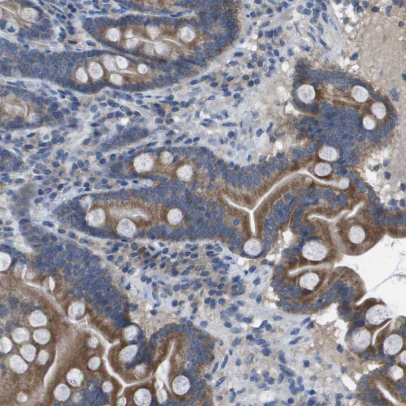 Atlas Antibodies Anti-CLCA4 Antibody