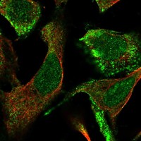 Atlas Antibodies Anti-CLCA4 Antibody
