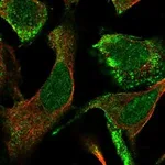 Atlas Antibodies Anti-CLCA4 Antibody