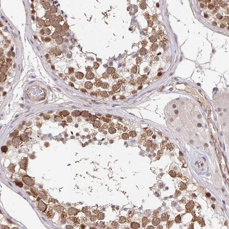 Atlas Antibodies Anti-CLASRP Antibody