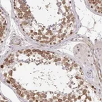 Atlas Antibodies Anti-CLASRP Antibody
