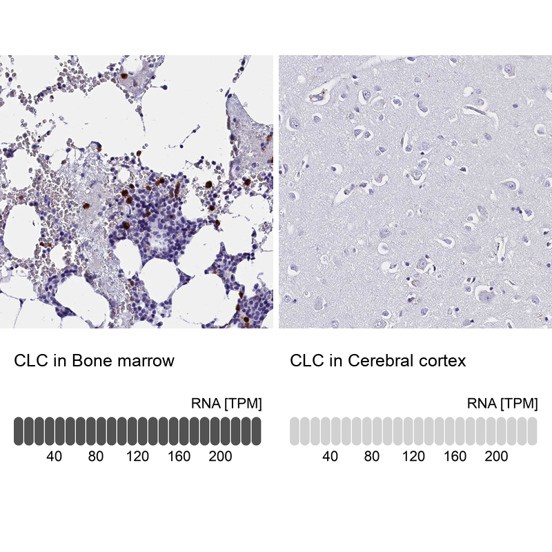 Atlas Antibodies Anti-CLC Antibody