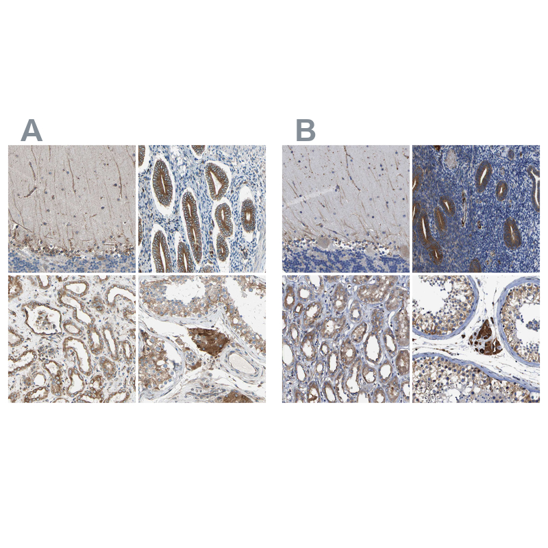Atlas Antibodies Anti-CLCC1 Antibody
