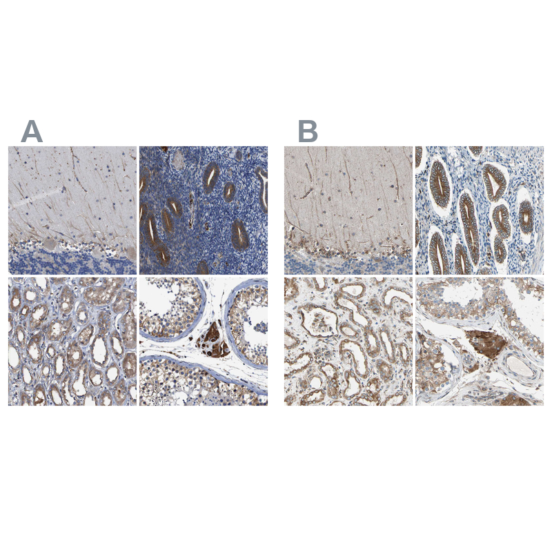 Atlas Antibodies Anti-CLCC1 Antibody