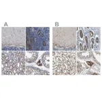 Atlas Antibodies Anti-CLCC1 Antibody