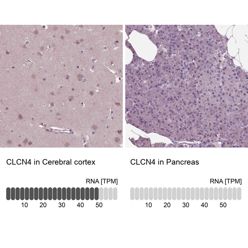 Atlas Antibodies Anti-CLCN4 Antibody