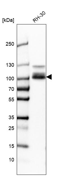 Atlas Antibodies Anti-CLCN5 Antibody