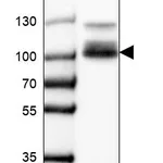 Atlas Antibodies Anti-CLCN5 Antibody