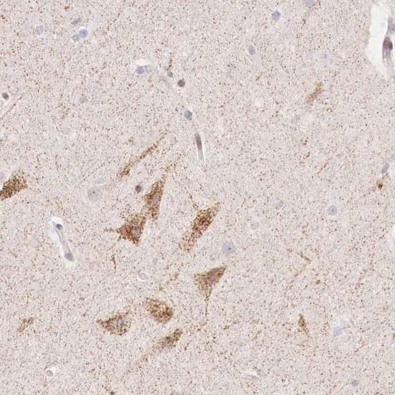 Atlas Antibodies Anti-CLCN5 Antibody