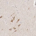 Atlas Antibodies Anti-CLCN5 Antibody