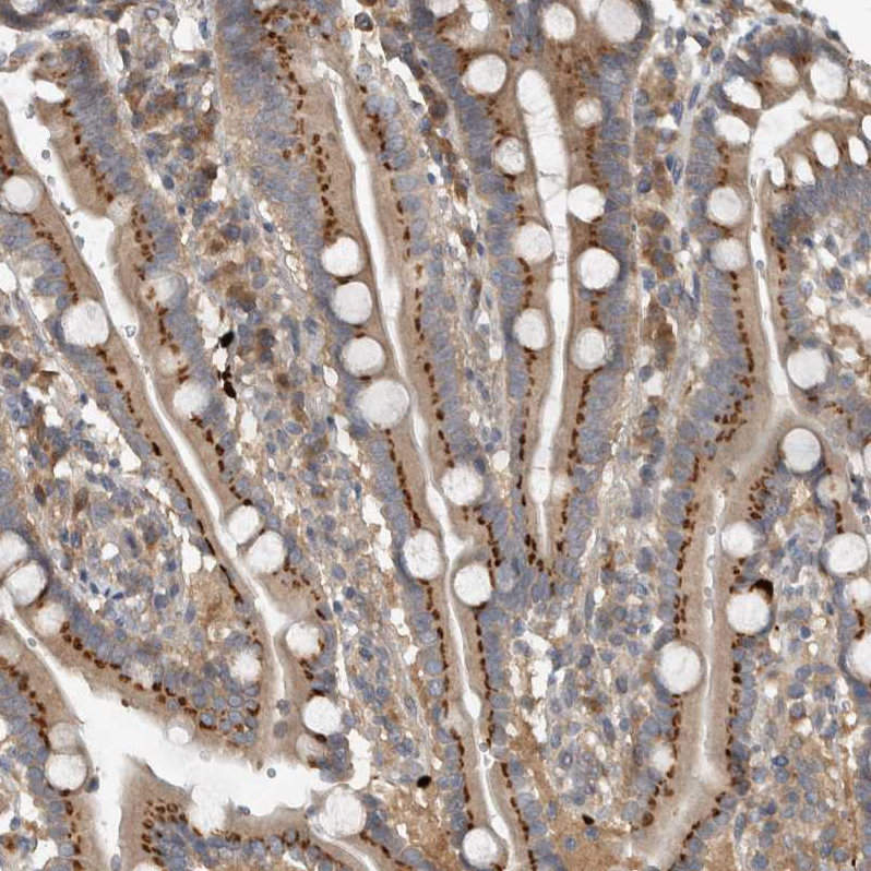 Atlas Antibodies Anti-CLCN2 Antibody