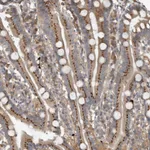 Atlas Antibodies Anti-CLCN2 Antibody