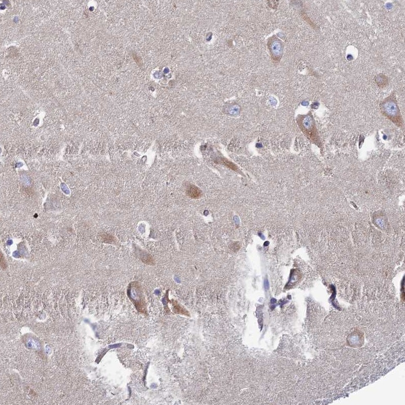 Atlas Antibodies Anti-CLCN3 Antibody