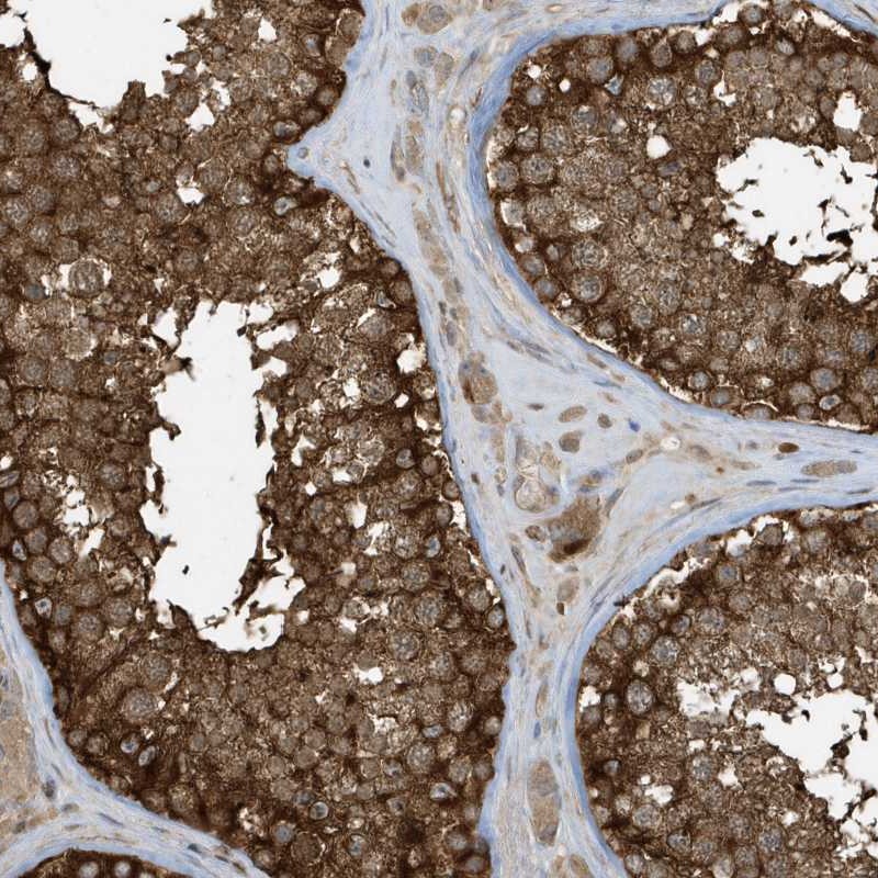 Atlas Antibodies Anti-CLCN6 Antibody