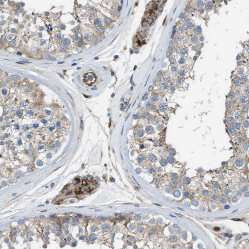 Atlas Antibodies Anti-CLCN2 Antibody