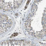 Atlas Antibodies Anti-CLCN2 Antibody
