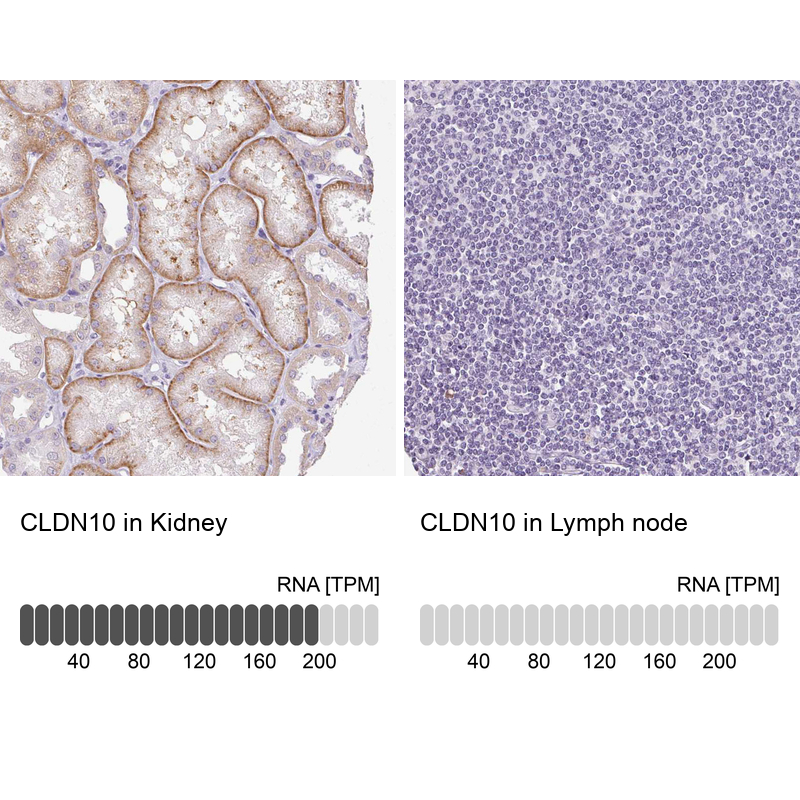 Atlas Antibodies Anti-CLDN10 Antibody