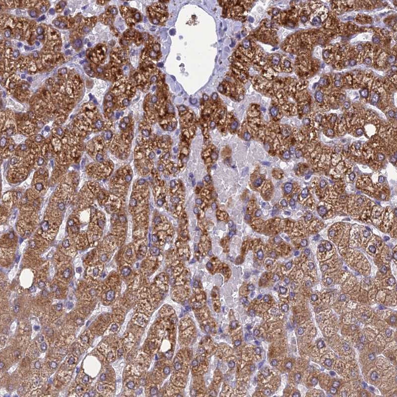 Atlas Antibodies Anti-CLCN7 Antibody