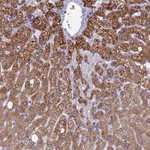 Atlas Antibodies Anti-CLCN7 Antibody