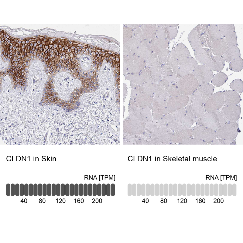 Atlas Antibodies Anti-CLDN1 Antibody
