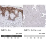 Atlas Antibodies Anti-CLDN1 Antibody