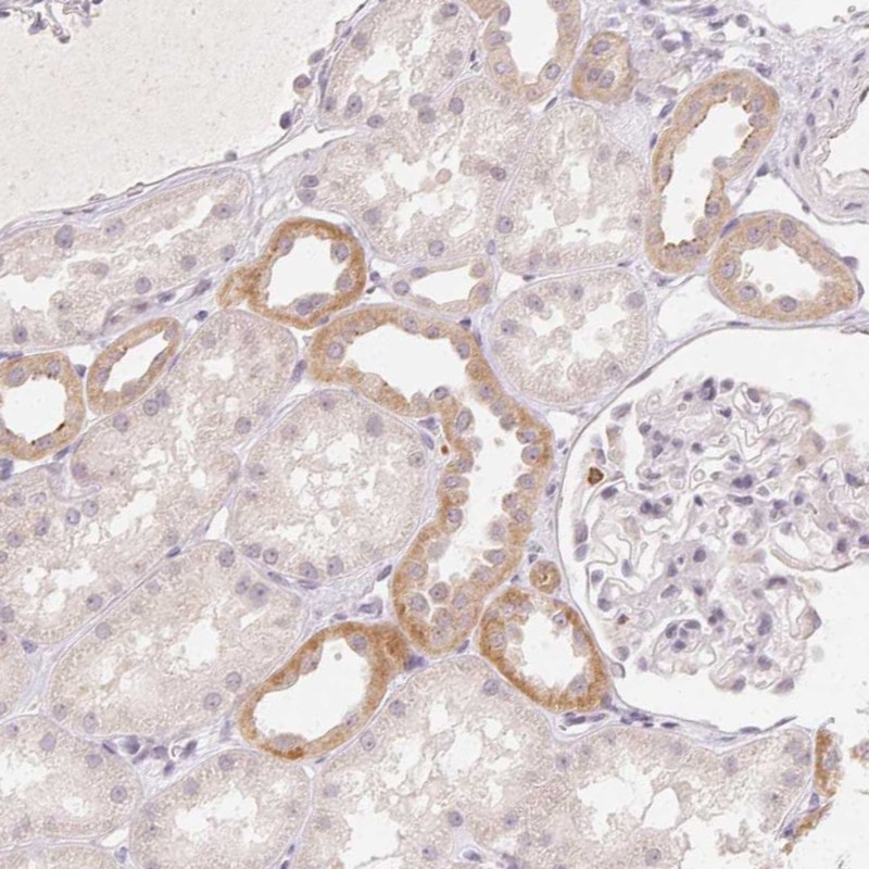 Atlas Antibodies Anti-CLCNKA Antibody