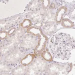 Atlas Antibodies Anti-CLCNKA Antibody