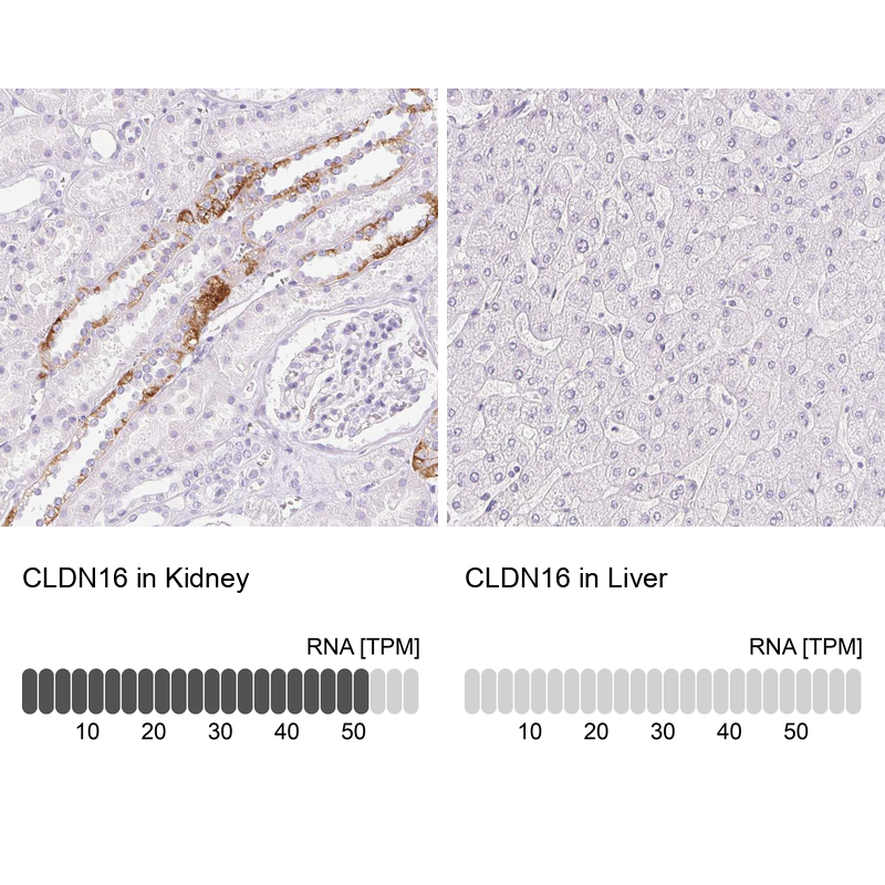 Atlas Antibodies Anti-CLDN16 Antibody