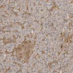 Atlas Antibodies Anti-CLDN12 Antibody