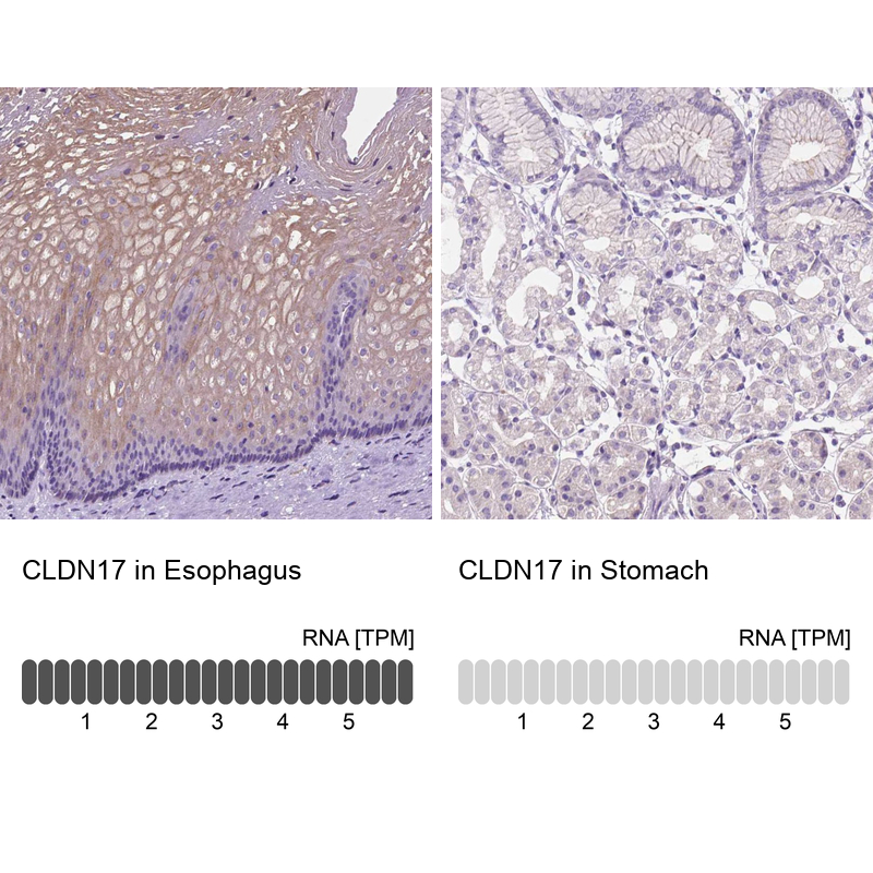 Atlas Antibodies Anti-CLDN17 Antibody