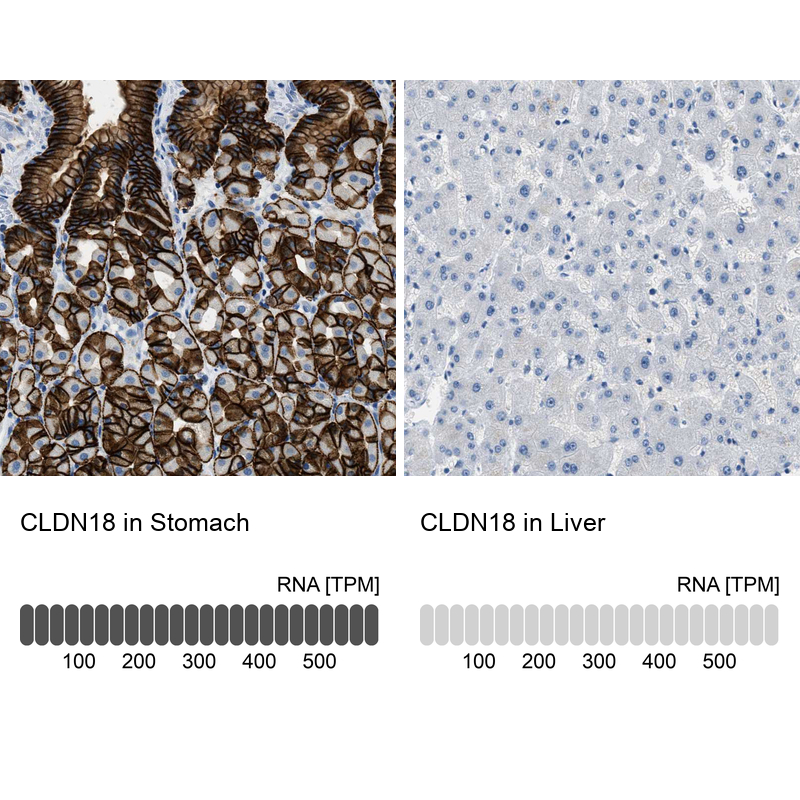 Atlas Antibodies Anti-CLDN18 Antibody