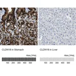 Atlas Antibodies Anti-CLDN18 Antibody