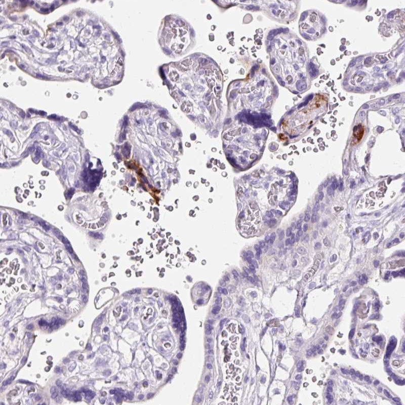 Atlas Antibodies Anti-CLDN25 Antibody