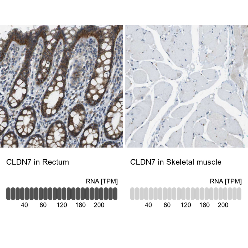 Atlas Antibodies Anti-CLDN7 Antibody