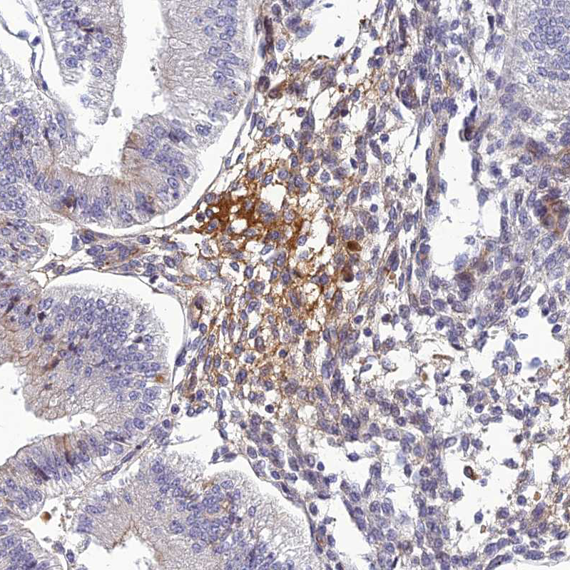 Atlas Antibodies Anti-CLEC11A Antibody