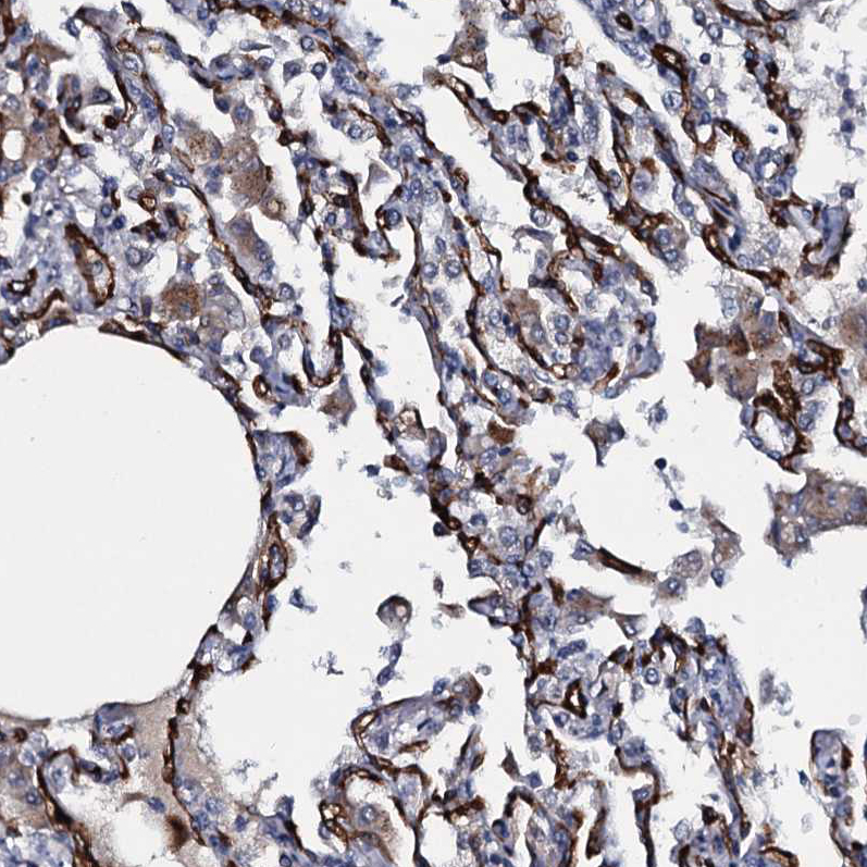 Atlas Antibodies Anti-CLEC14A Antibody