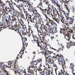 Atlas Antibodies Anti-CLEC14A Antibody