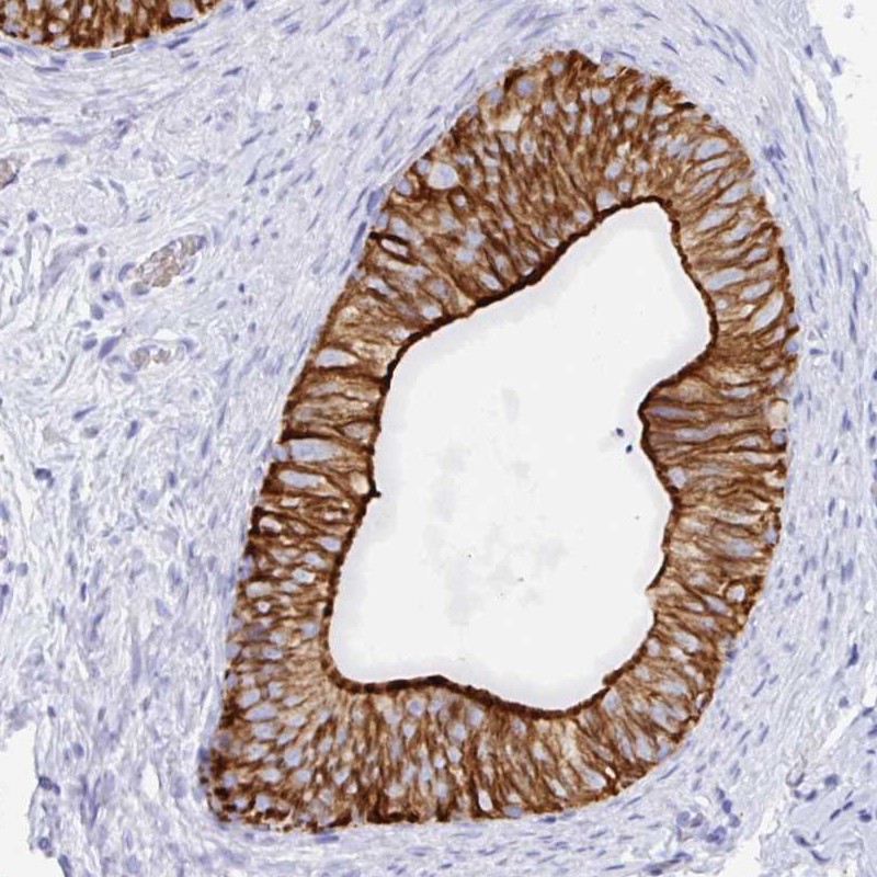 Atlas Antibodies Anti-CLDN8 Antibody