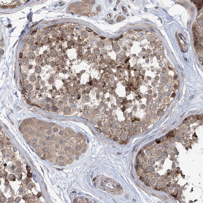 Atlas Antibodies Anti-CLEC16A Antibody