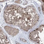 Atlas Antibodies Anti-CLEC16A Antibody