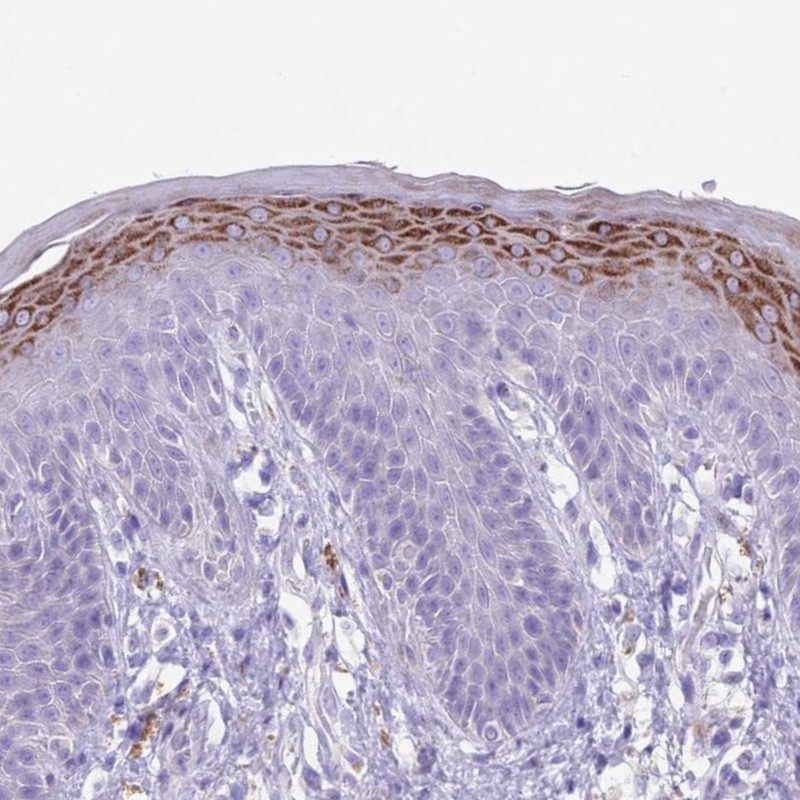 Atlas Antibodies Anti-CLEC2A Antibody