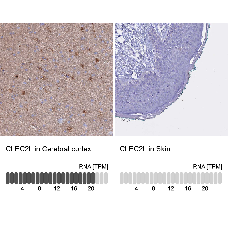Atlas Antibodies Anti-CLEC2L Antibody