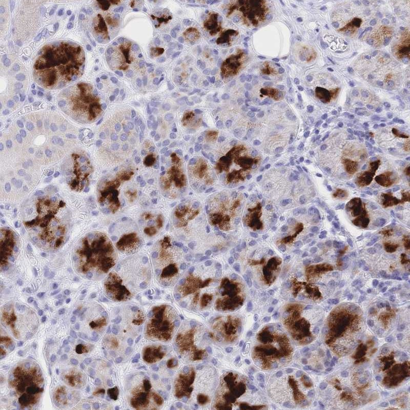 Atlas Antibodies Anti-CLEC18B Antibody