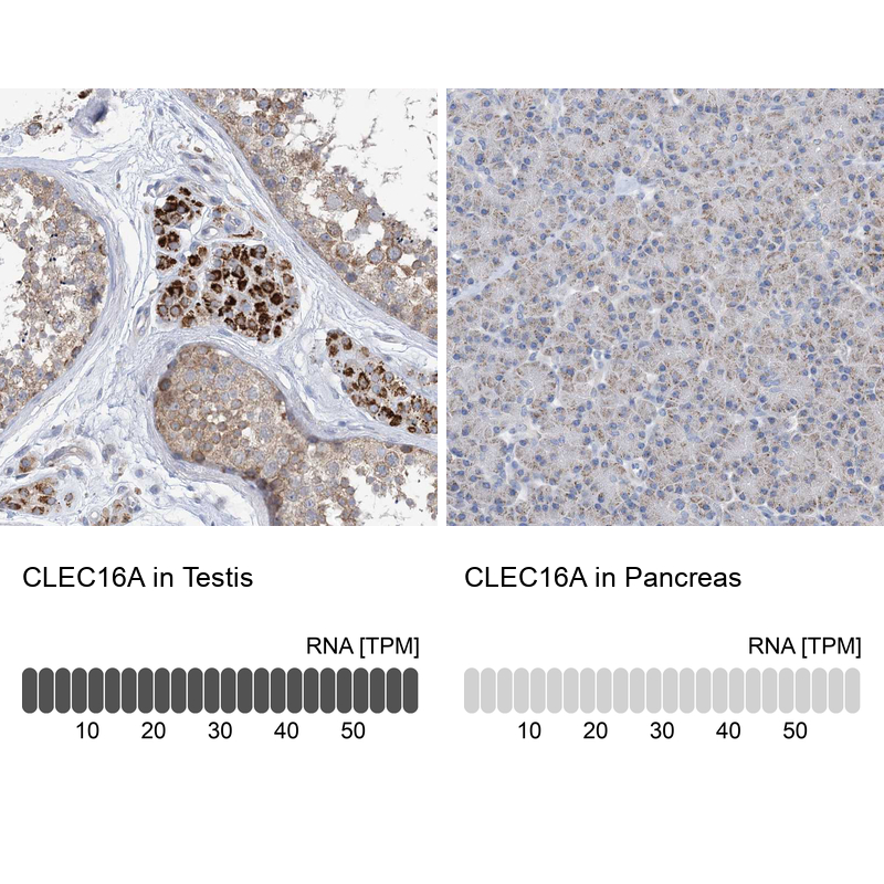 Atlas Antibodies Anti-CLEC16A Antibody