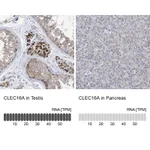 Atlas Antibodies Anti-CLEC16A Antibody