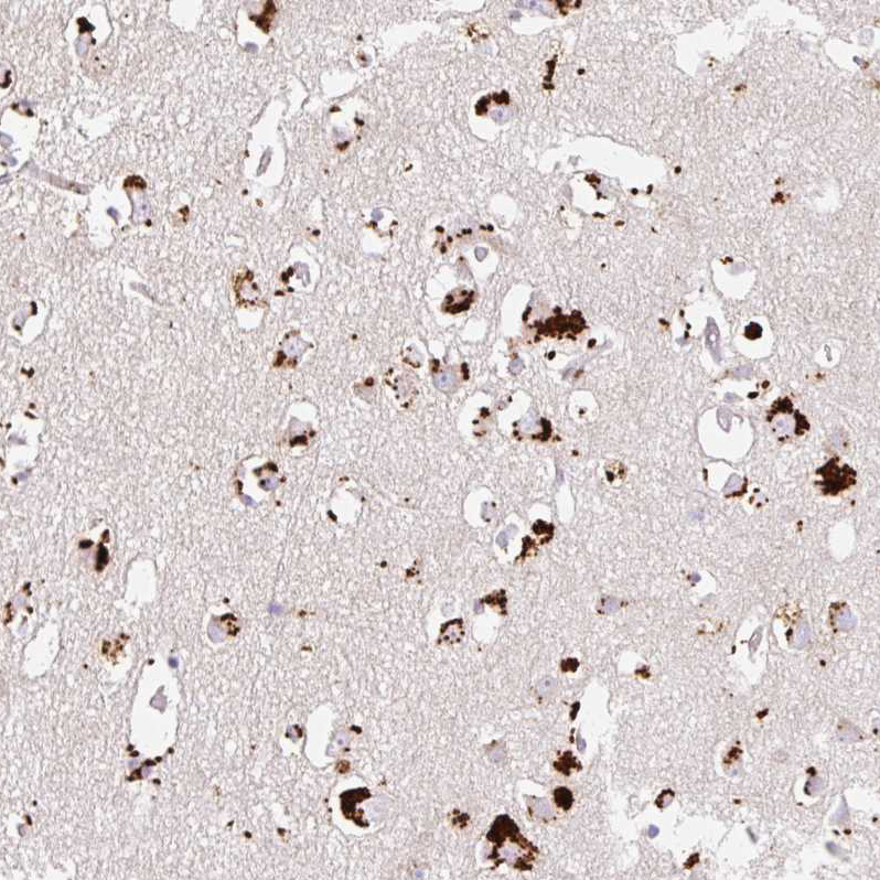 Atlas Antibodies Anti-CLEC3A Antibody