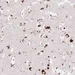 Atlas Antibodies Anti-CLEC3A Antibody