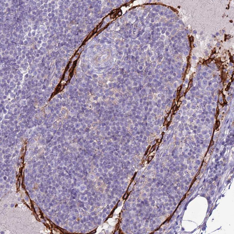 Atlas Antibodies Anti-CLEC4M Antibody