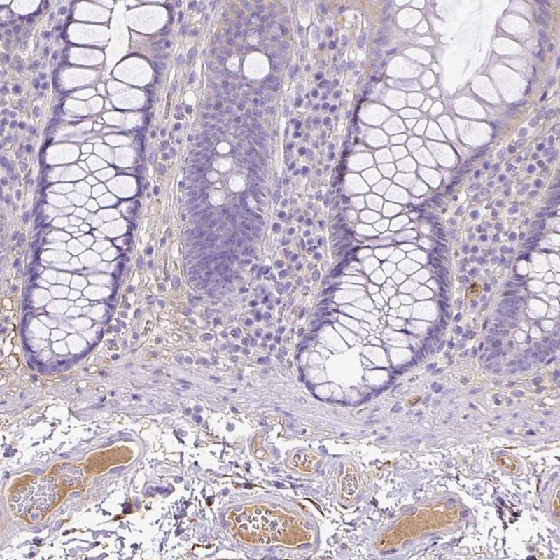Atlas Antibodies Anti-CLEC3B Antibody